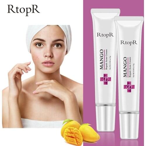 2pcs Acne Cream Face Anti Acne Treatment Whitening Cream oil control Fine pores Remove Face Acne And Blackhead Scar Skin Care