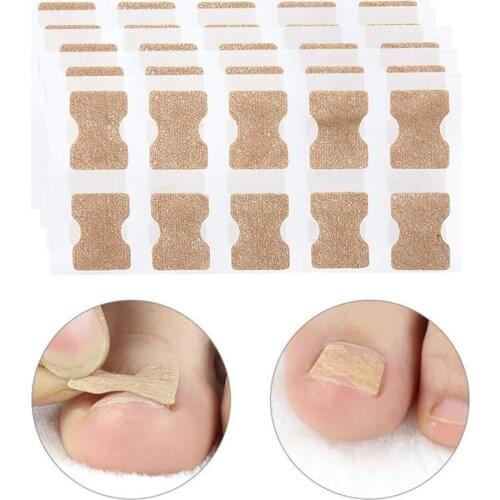 50Pc Paronychia Toenail Treatment Tape Ingrown Toenail Tape Correction