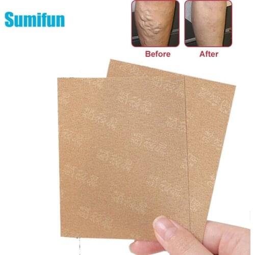 2Pcs Herbal Medical Spider Veins Varicose Treatment Plaster Varicose Veins Cure Patch Pain Relieve Inflammation Vein C1993