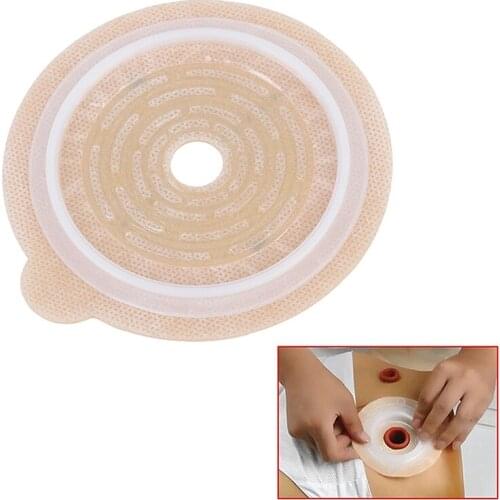 1Pcs Base Plate Two-piece System Ostomy Bag Baseplates Colostomy Bags Stoma random