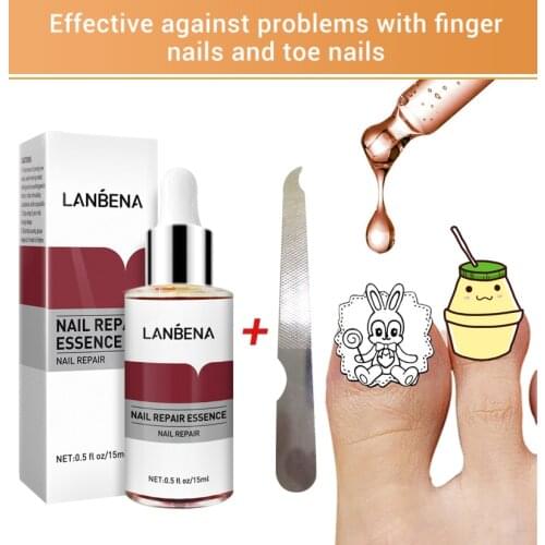 LANBENA Fungal Nail Repair Liquid Toe Care Repair Nail Repair File Anti Removedor Removal Gel Anti Paronychia OnychomycosisTSLM1
