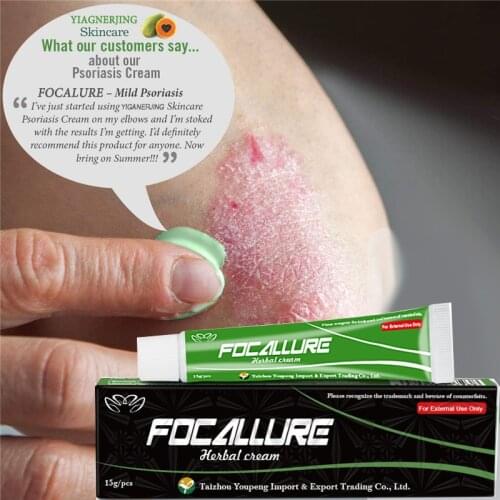 30PCS Wholesale Yiganerjing Focallure Herbal Anti Bacteria Body Dermatitis Eczematoid Eczema Ointment Treatment Psoriasis Cream