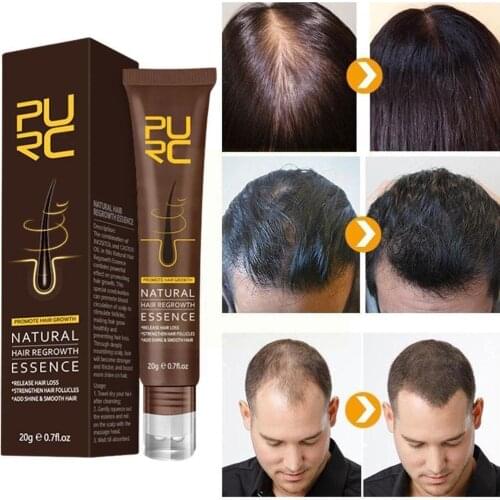 20g Hair Loss Prevention Hair Lotion Hair Growth Nourishes Dense High-concentration Of Massage Essence Roots The Ampoule Q2G2