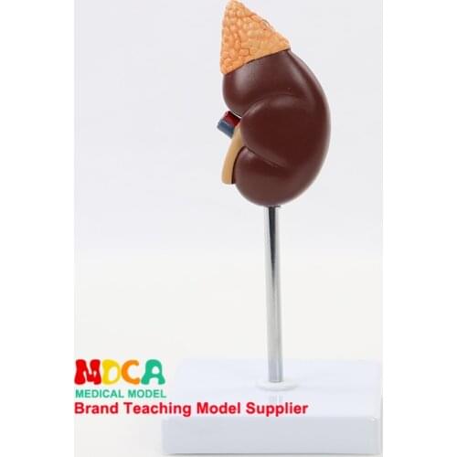 Medical Teaching of Urinary System and Renal Structure for Natural Large Kidney Model in Human Urology Department MSZ002