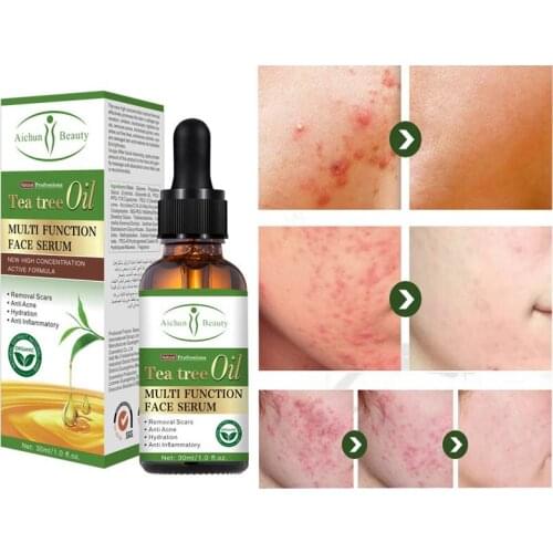 Tea Tree Oil Serum Acne Treatment Hyaluronic Acid Face Serum Moisturizer Whitening Essence Skin Care Cosmetics 30ml