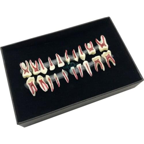 1Box Dental Oral Anatomical display model Teaching Model Dental Oral Deciduous Teeth Model Childs deciduous tooth