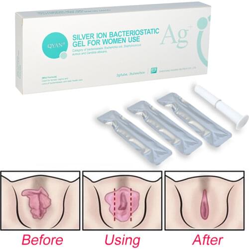 Buy 3 get 1 free silver ion bacteriostatic gynecological gel for women vagina tighting repair feminine hygiene vaginal health