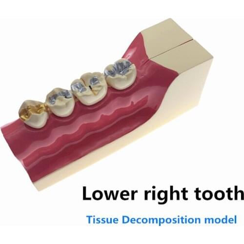 Dental Disease Molar Cross Section Model Teeth Anatomy Study Model