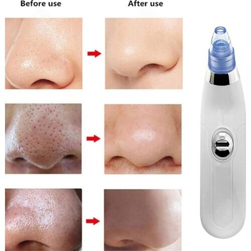 Pore Cleaner Blackhead Remover Vacuum Electric Nose Face Deep Cleansing Come do Suction Facial Beauty Machine Skin Care Machine