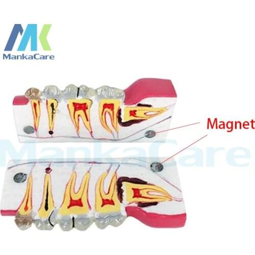 2 times Sagitally Section Model/Tissue decomposition model for Doctor - patient communication model with magnetic
