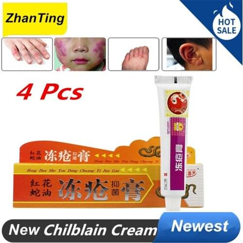 ZhanTing Foot Frostbite Cream Chinese Medicinal Ointment Hand Crack Cream Peeling Repair Frostbite Anti Dry Crack Skin Creams