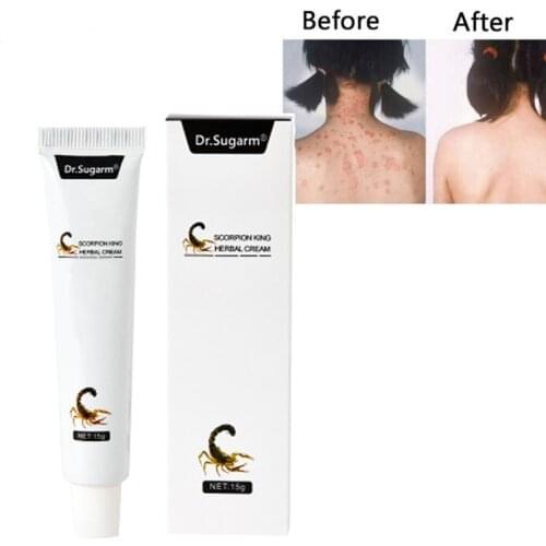 1/2pcs 15gEczema Psoriasis Cream for Intimate Pruritus Dermatitis,Jock Itch,Mosquito bites, Anti-itch Herbal Antibacterial Cream