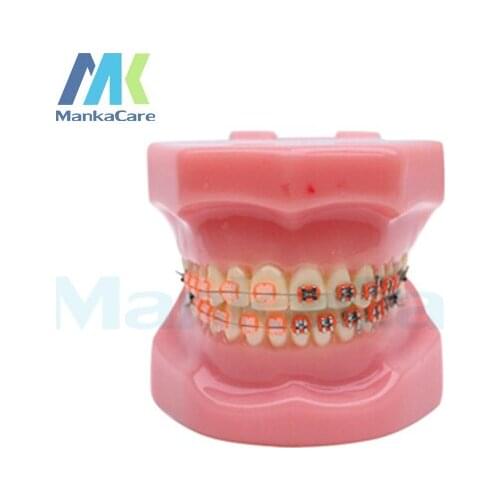 Manka Care - 28 pcs Tooth, half metal&half ceramic bracket Oral Model Teeth Tooth Model