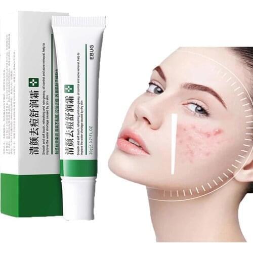 Effective Acne Removal Cream Acne Treatment Fade Acne Spots Oil Control Shrink Pores Whitening Moisturizing Acne Cream Skin Care
