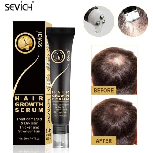 Sevich Hair Fluffy Powder water proof hair line powder black brown Instantly Root Cover Up Hair Shadow Powder Unisex 10 color