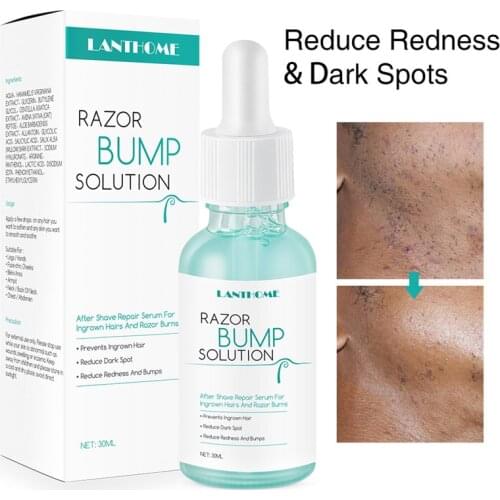 Ingrown Hairs Treatment After Shave Repair Reduce Redness&Dark Spots Serum for vanish pfb Razor Burns for black Men Bikini area