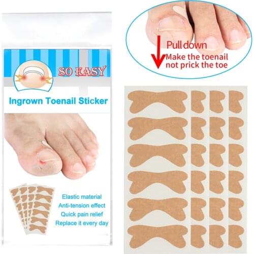 Ingrown Toe Nail Correction Sticker Elastic Straighten Clip Orthotics Patch Foot Care Treatment Foot Pedicure Corrector