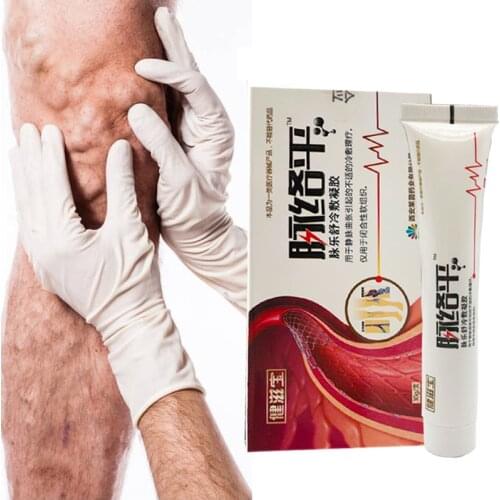 30g Varicose Veins Treatment Cream Treatment Vasculitis Phlebitis Massage Relieve Swelling Vasculitis Health Care Ointment