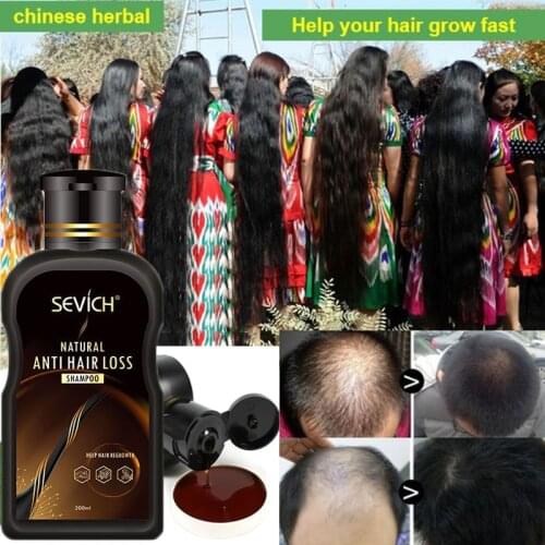 200ml Hair Care Product Ginger Anti Hair Loss Hair Growth Serum Shampoo Effective Hair Loss Treatment Cool Hair Growth Liquid