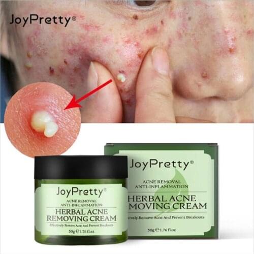 50g Herbal Against Anti Face Acne Pimple Remover Treatment Cream Patch Cleansing Moisturizing Korean Facial Skin Care Cosmetic