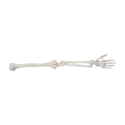 Life-Size Lower Limb ( Left\ Right Arm) Skeleton Model BIX-A1030 WBW305