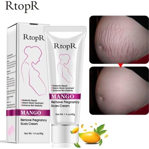 RtopR Mango Remove Pregnancy Scars Acne Cream Stretch Marks Treatment Maternity Repair Anti-Aging Skin Firming Body Creams