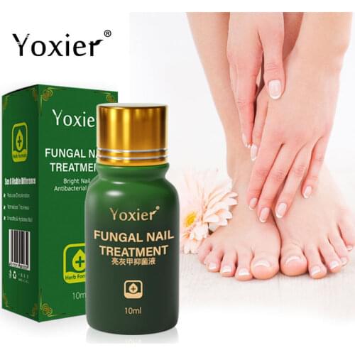 Yoxier Fungal Nail Treatment Feet Care Serum Antibacterial Herbal Formula Repair Anti Infection Paronychia Onychomycosis 10ml