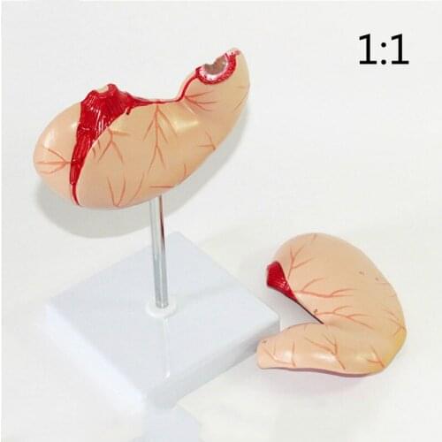 1:1 stomach Anatomical model Gastric model Medical teaching model training model of digestive department
