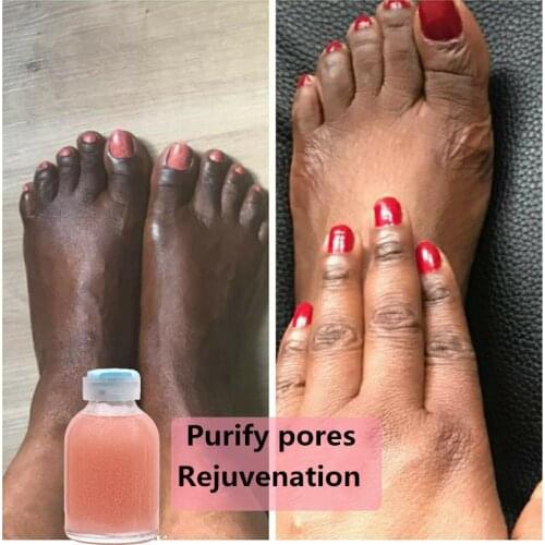 Strong Hand and Feet Lightening Whitening Cleasing Serum. To Clean Up Dark Knuckles Melting and Brightening The Skin 30ml