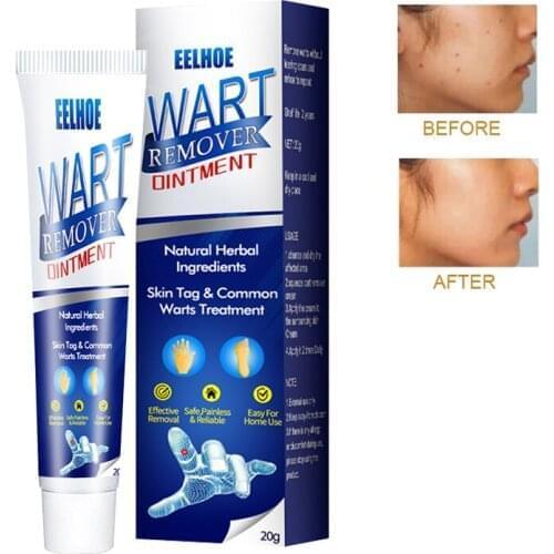 Remover Antibacterial Ointment Wart Treatment Cream Skin Tag Remover Herbal Extract Corn Plaster Warts Ointment