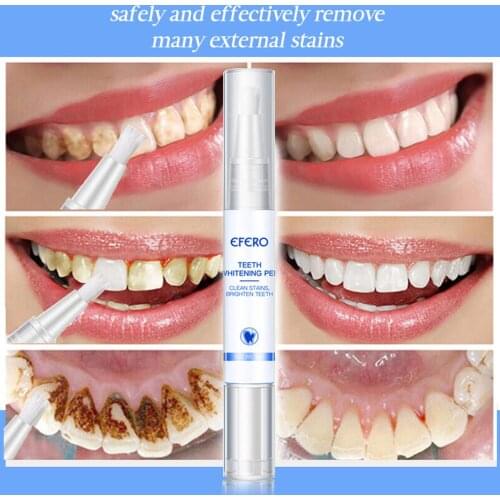 Popular White Teeth Whitening Pen Tooth Gel Bleach Remove Stains Oral Hygiene Home Oral Care Tooth Bleaching Pen Hot Sale