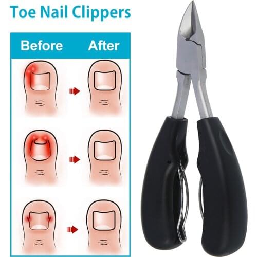 Toe Nail Clippers Dead Skin Dirt Remover Ingrown Toenail Cutters Anti-Splash Paronychia Correction Pedicure Tool Nail Supplies