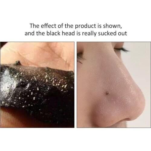 LIRAINHAN Blackhead Strips For Face