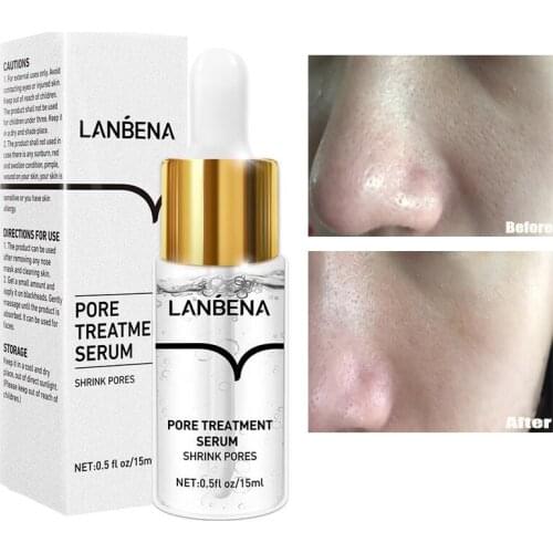 Восстанавливающие сыворотки для лица ROSOTENA China At AliExpress