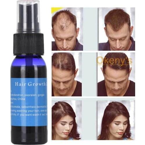 30ml Proffesional Effective Ginger Hair Growth Essential Oils Anti Hair Loss Promote Thick Hair Fast Growth Products TSLM1