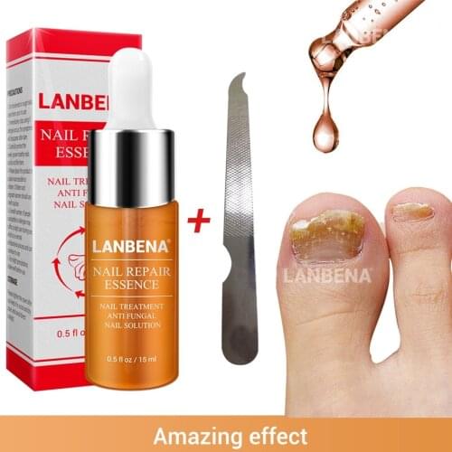 LANBENA Nail Fungus Treatment Essence Cuticle Oil 15ml Antifungal Nail Repair Toe Finger Fungus Removal Onychomycosis Nail care