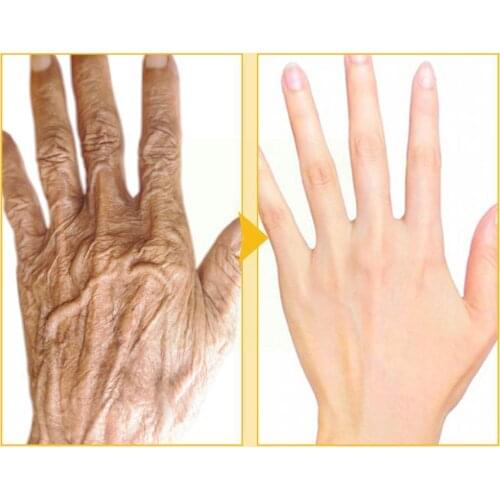 50g Mango Moisturizing Hand Mask Wax Whitening Skin Skin Hand Calluses Repair Exfoliating Hand Cream Care E0N7