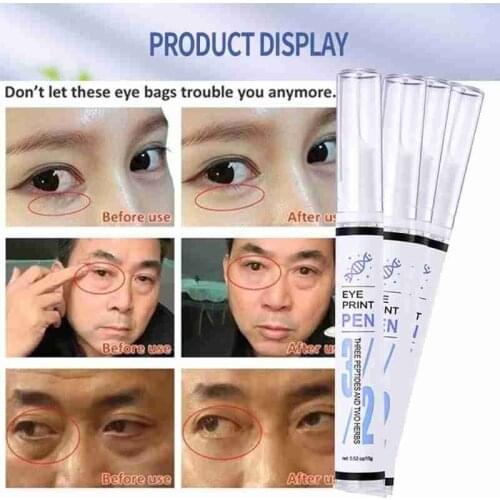 Anti-aging Eye Cream Reduces Fine Lines And Dark Circles Tightens The Skin Repairs The Skin Around The Eyes Prevents Fat Part
