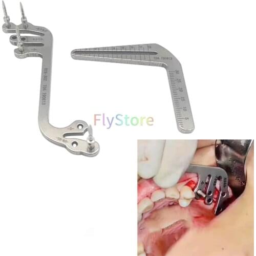 Dental implant surgery instruments Oral implant positioning guide, dental implant positioning angle dentist tools