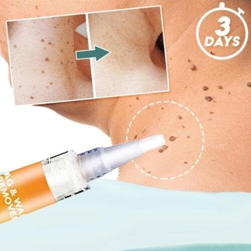 Wart Treatment Cream Warts Remover Antibacterial Ointment Skin Tag Remover Herbal Extract Foot Corn Plaster Warts Ointment