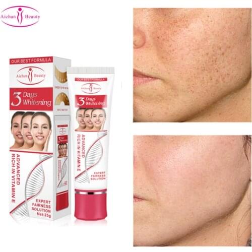 Whitening Face Cream Nicotinamide 3 Days Freckle Removal Improve Dullness Anti Wrinkle Remove Dark Spot Fast Whiten Skin Care