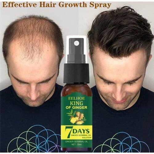 30mlHair Growth Essence Germinal Serum Essence Oil Natural Hair Loss Treatement Effective Fast Growth Scalp Treatment Men Women