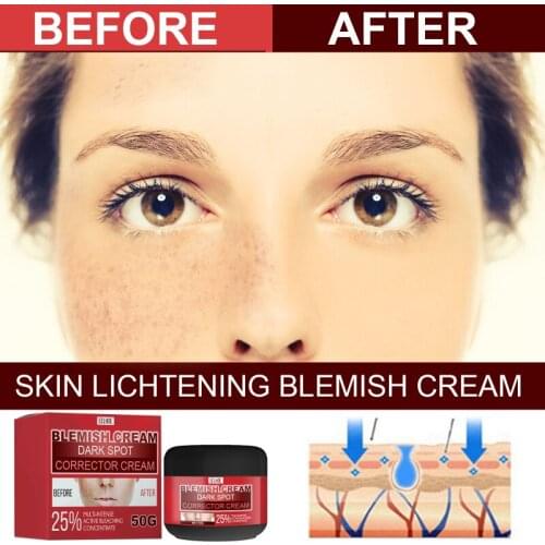 Face Cream Effective Whitening Remove Dark Spots Facial Cream Repair Fade Freckls Melanin Remover Brighten Moisturizing TSLM1