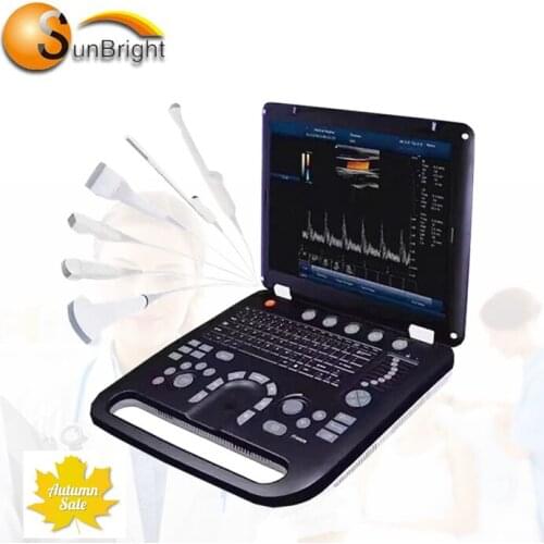Medical 4D color Doppler machine ecografo portatil ultrasound scanner CW PW cardiac ultrasound