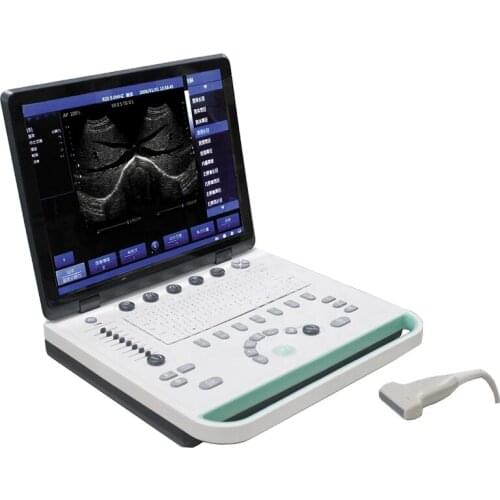 IN-A032-2 ICEN 3d ICEN Portable Digital laptop Ultrasound scanner machine