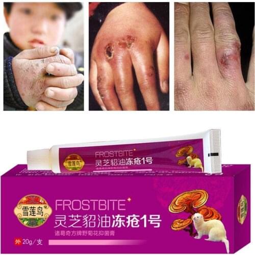 Heel Chapped Peeling Repair Chinese Medicinal Ointment Dry Crack Hand Dry Chapped Anti Cream Cream Skin Foot Treatment Crea Z9I2