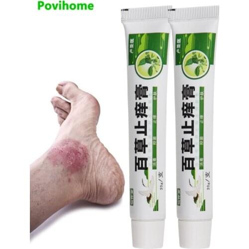 2pcs Herbal Natural Cream Relieves Dryness, Itch, and Inflammation Natural Eczema Psoriasis Ointment Dermatitis Eczematoid Patch