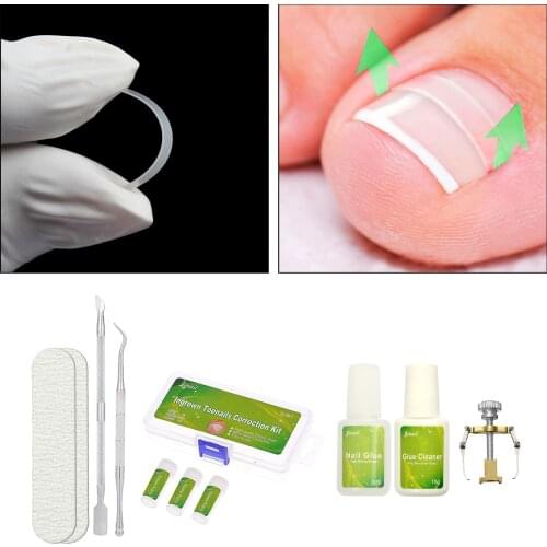 10pcs Toenail Patch Ingrown Correction Tool Set Toe Nail Ingrown Pedicure Patch Straightening Clip with Glue Pedicure Care Set