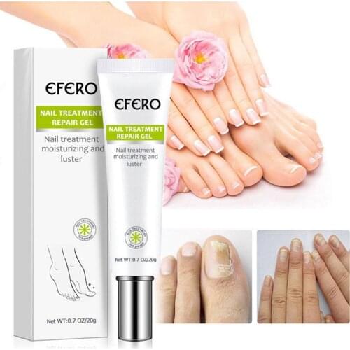 20g Nail Repair Cream Fungus Treatment Solution Anti Fungal Removal Infection Cuticle Toe Nail Foot Protector Cream Feet Care
