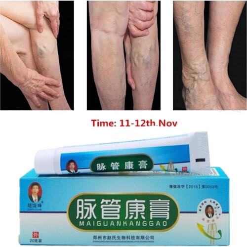 Varicose Veins Treatment Cream Ointment Vasculitis Angiitis Phlebitis Spider Veins Pain Remedy Herbal Body Cream Drop Shipping